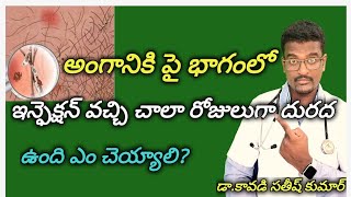 How to Cure Pubic LiceCrabs Infection in privite part Telugu  Doctor Satheesh  Yes1TV Health [upl. by Airottiv449]