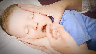 How to Give Your Child Buccal Midazolam [upl. by Calore543]