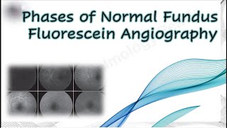 Phases of Normal Fundus Fluorescein Angiography [upl. by Erkan737]