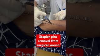 Multiple ways to close a surgical wound 1 nylon sutures 2 skin staplers 3 dermabond woundcare [upl. by Reisch318]