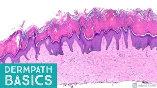 Basic Dermpath Cases  Explained by a Dermatopathologist [upl. by Aschim]