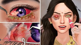 ASMR The best treatment swollen corners of eyes remove styered eyes and clean up leaky eyes [upl. by Peer]