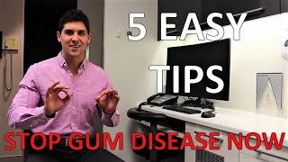 HOW TO STOP GUM DISEASE AND BLEEDING AT HOME Fix Gingivitis And Gum Pain 5 Simple Steps [upl. by Jehanna]