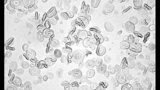 Heat Gelatinization of Wheat Starch low iodine [upl. by Urbannal975]