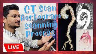 live CT Scan Aortogram scanning process and techniques  scanning process of Aortic Angiography [upl. by Ziladnerb481]