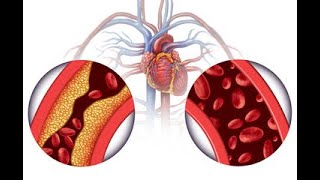 High Blood Pressure and Your Kidneys  A to Z Guide [upl. by Nnaerb]