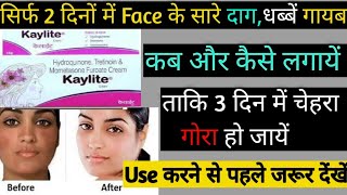 kaylite cream ke fayde nukshanuses price  gora hone ka cream  fairness cream  kaylite [upl. by Nohsal749]