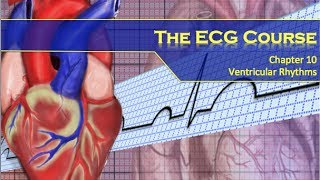 The ECG Course  Ventricular Rhythms [upl. by Nalym622]