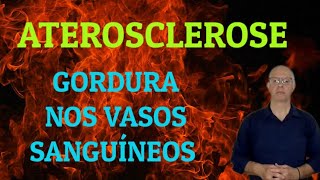 Aterosclerose O que significa [upl. by Sane218]