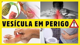 12 SINAIS de que sua VESÍCULA BILIAR está com PROBLEMAS PEDRAS NA VESÍCULA Dr Alain Dutra [upl. by Stargell372]