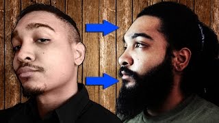 24 Men Who Grew FULLER Beards Using Minoxidil [upl. by Schreiber]