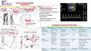 Insuficiencia Venosa y Trombosis Venosa Profunda [upl. by Sivram]