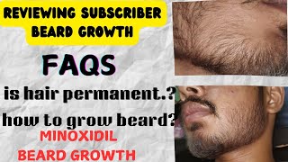 Minoxidil beard growth resultsReviewing my subscriber beard growth [upl. by Einaoj986]