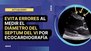 ⛔️EVITA ERRORES al medir el ✅DIÁMETRO DEL SEPTUM INTERVENTRICULAR por ecocardiografía [upl. by Arrat]