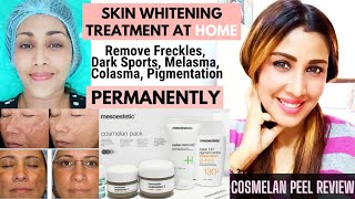 💯Permanent Whiter Skin at home Cosmelan Peel Review Before and After Cosmelan Treatment Lighten Skin [upl. by Nnitsuj]