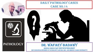 DAILY PATHOLOGY CASES CASE NO 14 BY DR WAFAEY BADAWY [upl. by Aitsirhc]