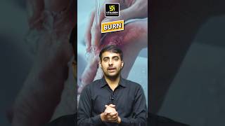 Bacteria is most commonly responsible for the sepsis in the burn patient shorts mukeshsir [upl. by Forras]