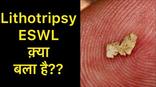 Lithotripsy Treatment for Kidney Stones in Hindi  Lithotripsy Side effects  ESWL Treatment [upl. by Adli]