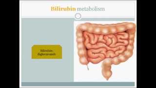 Jaundice made easy to understand HD [upl. by Lebanna]