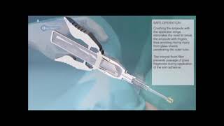 Liquiband Surgical S Bioargo Group [upl. by Getraer330]