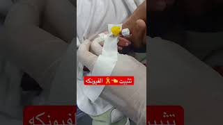 طريقه 👈🎗️ الفيونكه كانيولا صعبه في التثبيت استخدمها اكسبلور بيبي notjustanurse بيبيبيبي [upl. by Ahseiat]