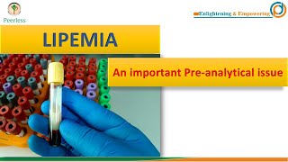 Lipemia An Important Pre analytical Issue in Lab [upl. by Ellata263]