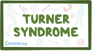 Turner syndrome Year of the Zebra [upl. by Fasta210]