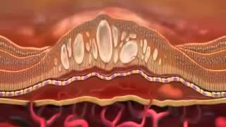 Lucentis ranibizumab [upl. by Salguod120]