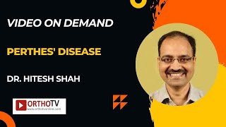 Perthes Disease  Dr Hitesh Shah [upl. by O'Dell]