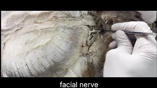 Facial nerve anatomy [upl. by Retsila]