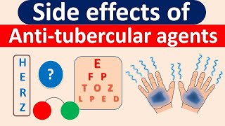 Side effects of AntiTubercular agents in easy way [upl. by Mickelson]