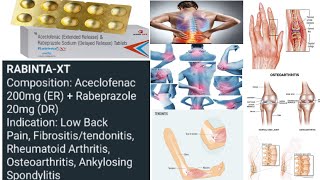 Treatment of low back pain  Fibrositis  Tendinitis  Osteoarthritis  Rheumatoid arthritis [upl. by Andryc]