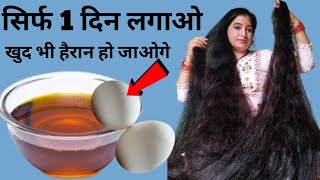 सिर्फ 1 दिन के इस्तेमाल से बालों को बढ़ता हुआ देख कर आप भी हैरान हो जाओगेEgg for hair growth [upl. by Ellesij748]