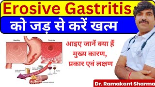 Erosive Gastritis A Comprehensive Guide to Causes Symptoms and Treatmentdrramakantsharma7 [upl. by Beth170]