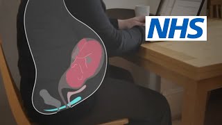 How and when should I do pelvic floor exercises  NHS [upl. by Hepsibah946]