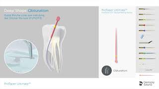 ProTaper Ultimate Endo File System  Obturation Sequence [upl. by Noxas]