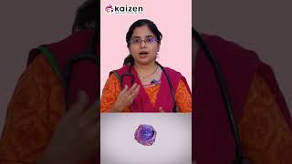 Does platelet count decrease in blood cancer  DrByreddy Poojitha bloodcancer plateletrichplasma [upl. by Airol]