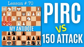 Pirc Defense VS The 150 Attack  Chess Lesson  70 [upl. by Bilski930]