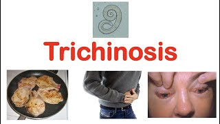 Trichinosis Pork Parasite  Pathophysiology Signs amp Symptoms Diagnosis Treatment [upl. by Amby]