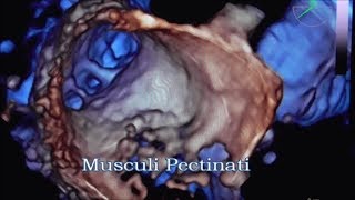 Musculi Pectinati [upl. by Arlyn795]