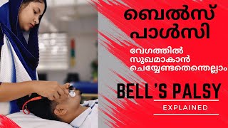 Bells Palsy Causes amp Treatmentബെൽസ് പാൾസി എങ്ങനെ വേഗത്തിൽ സുഖം പ്രാപിക്കാം bellspalsy arunvi [upl. by Roque803]