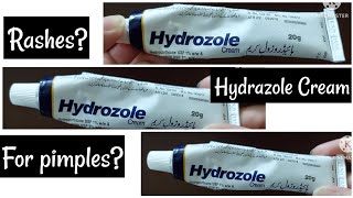 Hydrozole Cream review [upl. by Thaine]