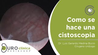 CISTOSCOPIA URETROSCOPIA DIAGNOSTICA [upl. by Dawkins]