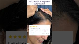 Rolling to Regrowth  Honest Reviews of Hair Serum RollOns HairgrowthReviews RollOnSerum [upl. by Talley326]