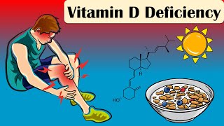 Vitamin D Deficiency  Causes Signs And Symptoms  Everything You Need To Know [upl. by Tonye]