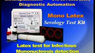 Mono Infectious Mononucleosis Serology kit [upl. by Ardnoel359]