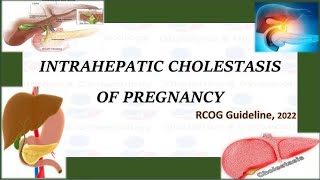 Intrahepatic Cholestasis of Pregnancy  RCOG Guideline 2022 [upl. by Lehcer751]