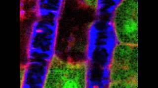 NIDCR Liver Vascular Flow [upl. by Umont]