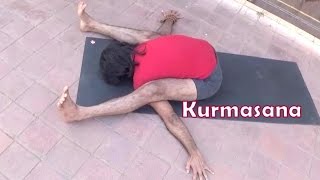 Kurmasana and Supta Kurmasana  Tortoise Pose  Ashtanga Power Yoga  Vyfhealth [upl. by Nahtnanhoj649]