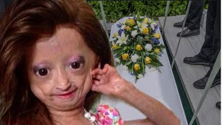 RIP Youtuber Adalia Rose Died Last Moment With her Mother😭This is so sd [upl. by Noraj]